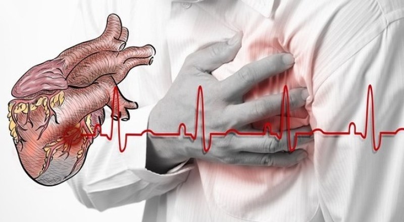 как да разпознаете признаците на инфаркт