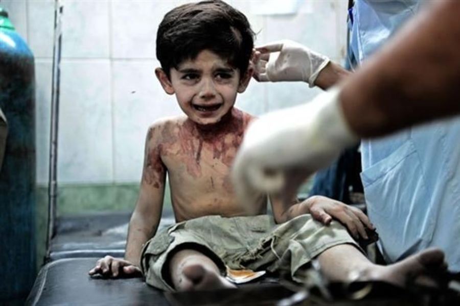 3 годишно сирийче преди да умре