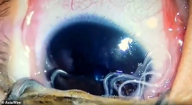 Майка на 5-месечно бебе го заведе в болница заради проблем с очите, лекарите онемяха заради причината (СНИМКИ/ВИДЕО 18+)