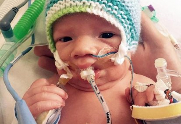 Лекари даваха само няколко минути живот на малко бебче, но се случи чудо (СНИМКИ)