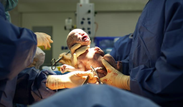 Лекарите извадиха това бебе от корема мъртво – последва чудо, което шокира дори докторите