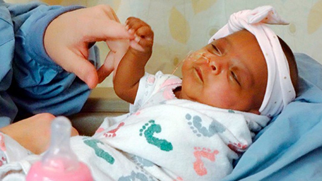 Лекари спасиха най-малкото бебе в света - 245 гр