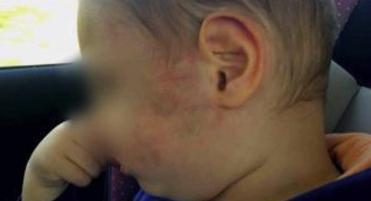 2-годишно момченце е пребито от възпитателка
