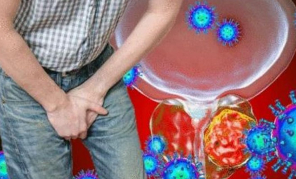 Как да открием рак на простатата