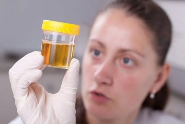 Миризмата на урината: кога става въпрос за сериозно заболяване?