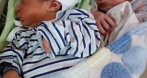 Жена роди близнаци, а лекарите и мъжът й онемяха щом видяха бебетата СНИМКИ