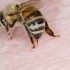Ето какво се случва с тялото ни когато ни ужили пчела