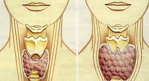 Десетки жени регулираха щитовидната си жлеза за 2 месеца с тази рецепта и казват че живеят нов живот