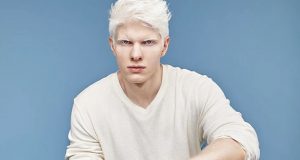 Просто ангел: как изглежда детето на най-красивия албинос в света (СНИМКИ)