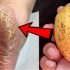 1 картоф = бебешки меки петички. Проста домашна процедура – помага дори при нацепена кожа
