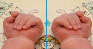Жена роди близнаци на две различни места в Пловдив
