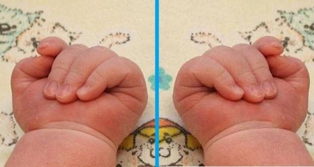 Жена роди близнаци на две различни места в Пловдив