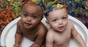 Близначки се родили през 1997 г. с различен цвят на кожата. Днес са големи красавици: