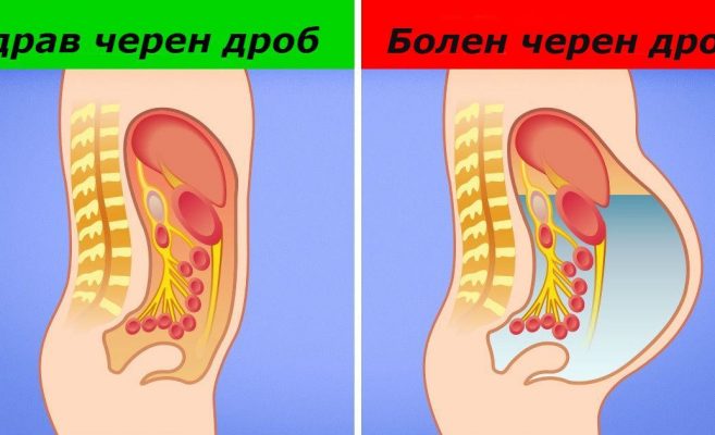 Революционно прочистване на черният дроб! Става за броени дни и без никакви лекарства (рецепта)!