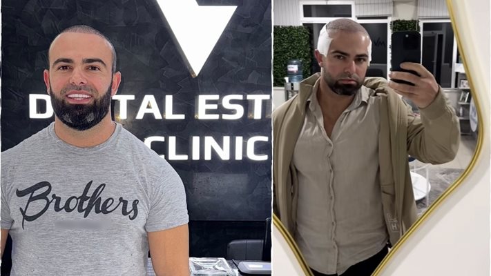 Ричард Величков: Имам нова коса, нови зъби и ново самочувствие!