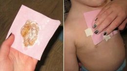 Ето как да свалите бързо температурата, без Панадол или Нурофен! Това е най-ефективният начин: