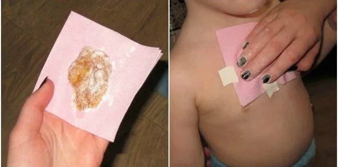 Ето как да свалите бързо температурата, без Панадол или Нурофен! Това е най-ефективният начин: