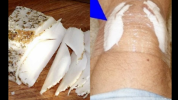 Накисвам сланината в ракия и слагам на коленете: Забравяш и болка и чудо! Вдига на крака даже куците: