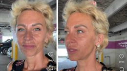 Нана Гладуиш призна: Откриха ми рак на кожата!