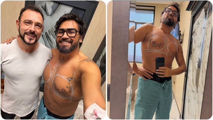 Азис си сложи мъжки силикон