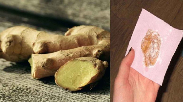 ТЕСТВАНО, РАБОТЯТ! 9 изпитани домашни компреса за различни заболявания - при възпаление, болка и температура