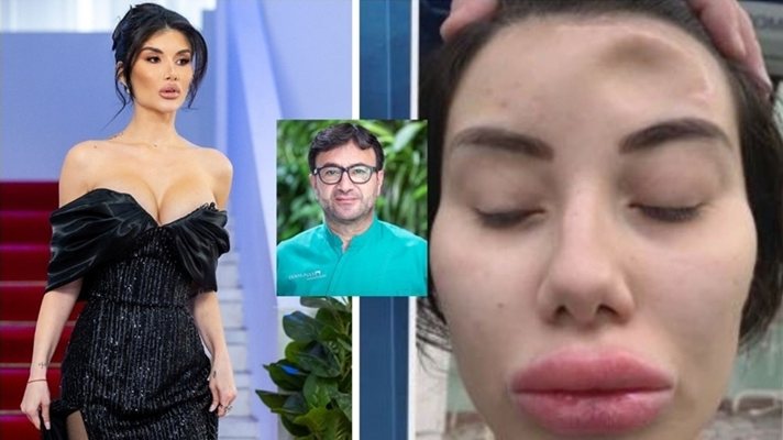 Катастрофиралата ергенка Пламена: Д-р Факих ме спаси никой не искаше да ми помогне!