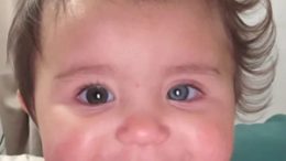 Бебе се роди с два цвята на очите, косата и кожата