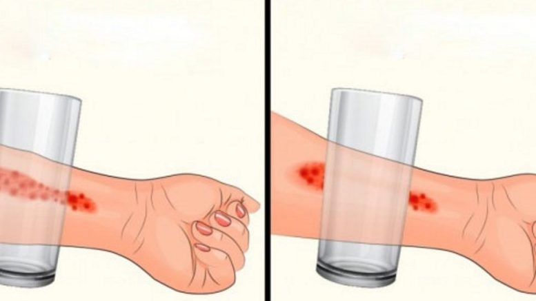 Разпознайте менингита: Това са симптоми, които не бива да пренебрегвате, потърсете помощ веднага щом ги забележите