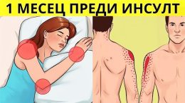 Тези симптоми могат да предупредят за инсулт до седмица по-рано: Ако ги забележите, незабавно се обадете на 112