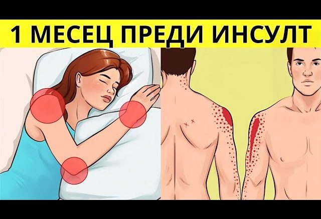 Тези симптоми могат да предупредят за инсулт до седмица по-рано: Ако ги забележите, незабавно се обадете на 112